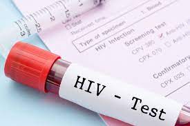 Xét nghiệm HIV khi dùng PEP